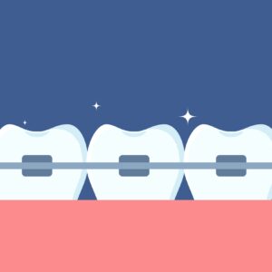 Row,Of,Teeth,With,Braces,On,Them.,Orthodontics,And,Aesthetic