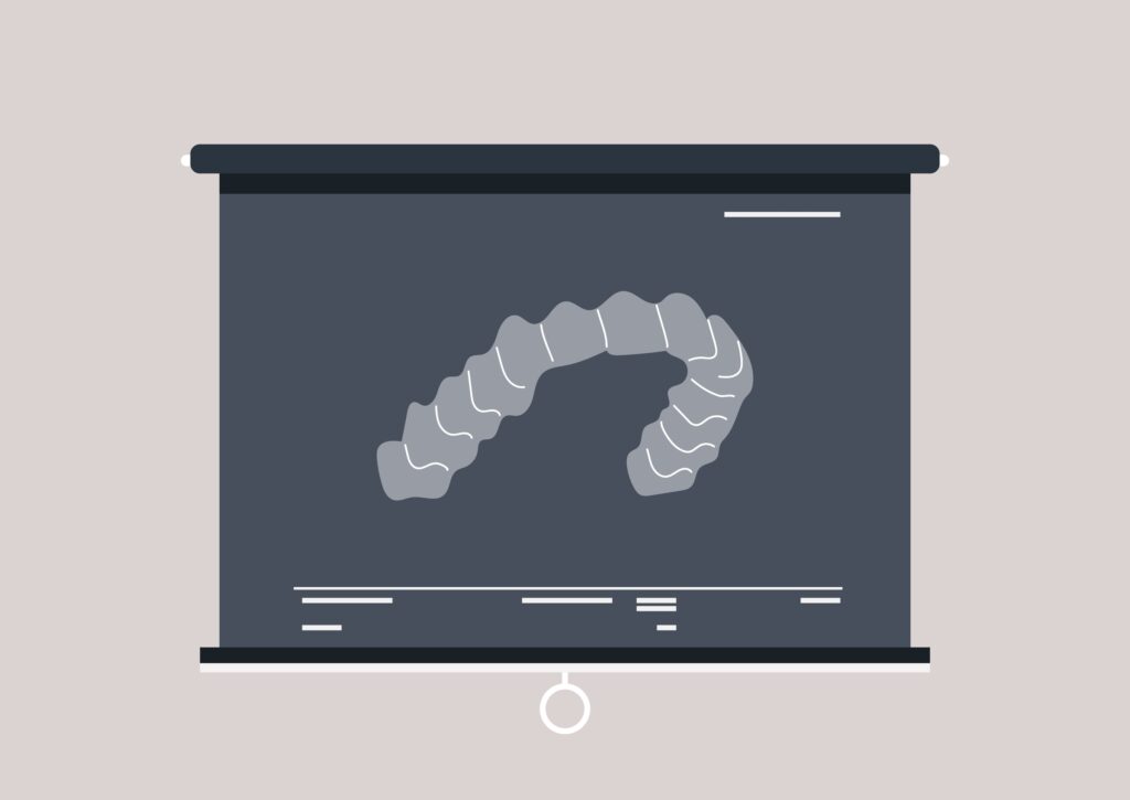 투명교정에 대한 설명