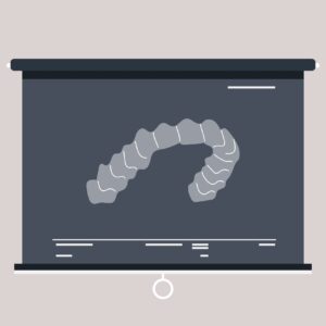 Highlighted,On,A,Display,Board,Is,A,Detailed,X,Ray