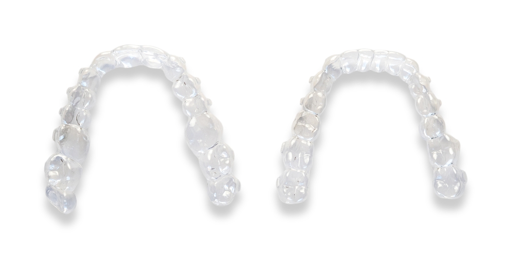 치아교정 이미지